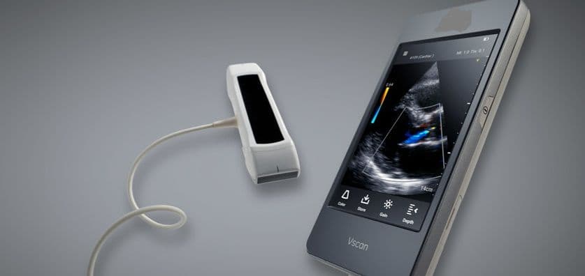 Due ecografi portatili donati alla terapia intensiva cardiochirurgica